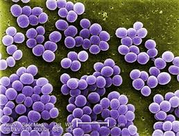 The Antibiotic Resistant S.aureus Can Be Destroyed With The New ‘Antibody-Antibiotic Conjugate,