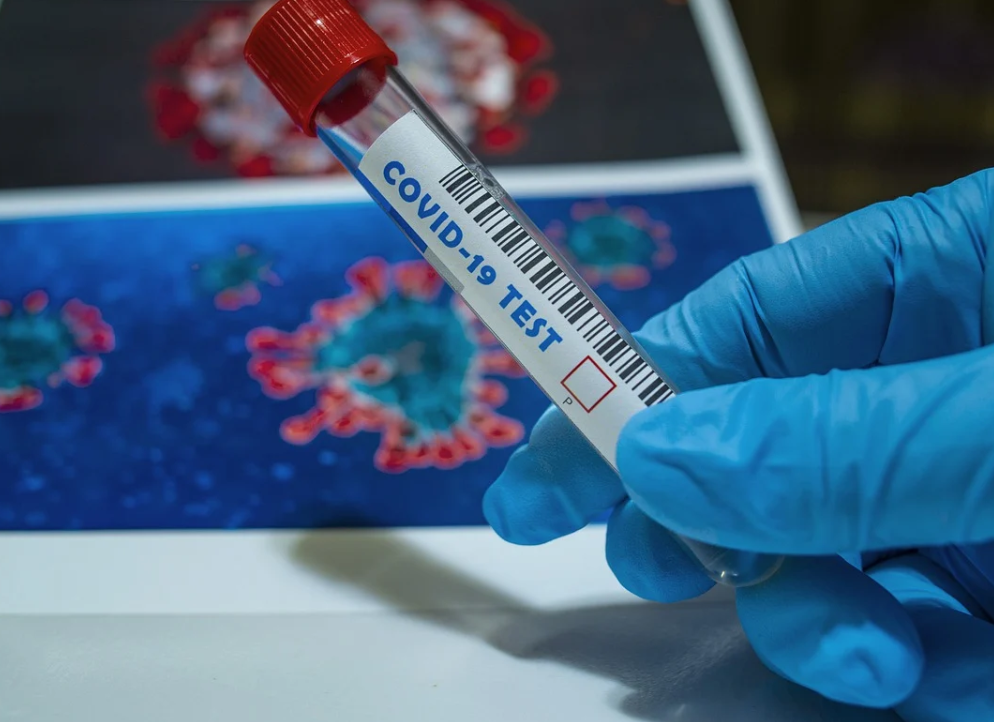 Over 60 countries call for independent investigation of COVID-19 origin
