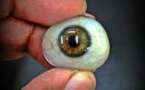 Smart And Adaptive Artificial Eye Developed By Researchers At Harvard