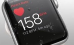 Large U.S. Study Finds Detection Of Irregular Heart Beat By Apple Watch