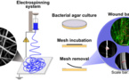 Bacteria Will Not Stand A Chance In Any Wound With The New Bandage Technology