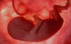 First 'in womb' Stem Cell Trial in Clinical Setting to Begin