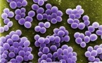 The Antibiotic Resistant S.aureus Can Be Destroyed With The New ‘Antibody-Antibiotic Conjugate,