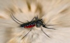 Sexual Transmission thought to be Behind the First Reported US Case of Zika Virus Transmission