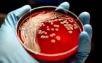 Superbugs may take $100 trillion from the global economy
