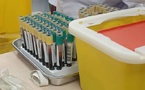 British hospitals and clinics stop taking blood tests due to heat