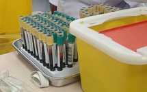 British hospitals and clinics stop taking blood tests due to heat